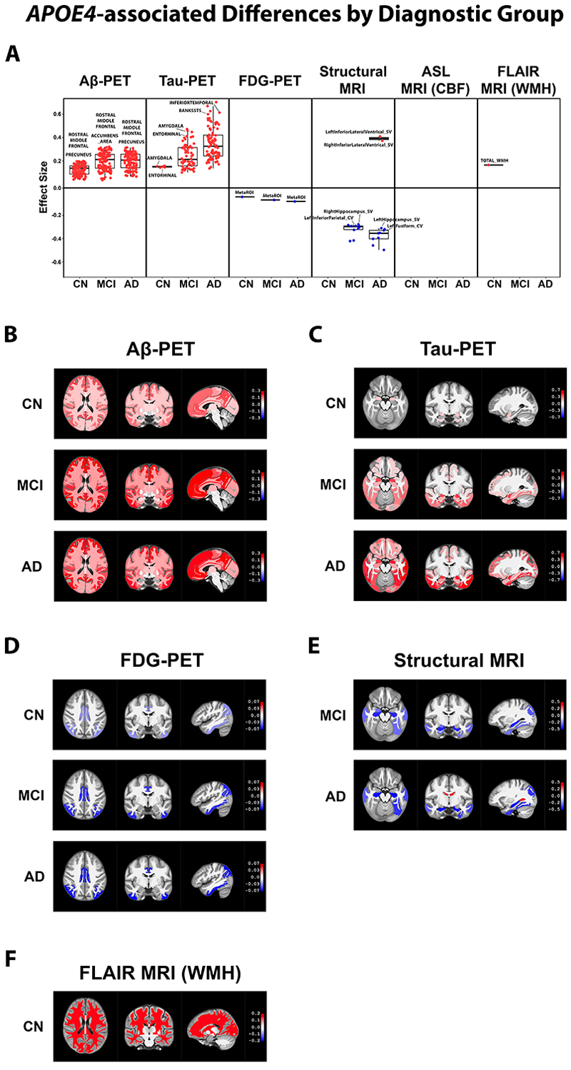 Figure 1. <em>APOE4</em>–associated differences by diagnostic group.